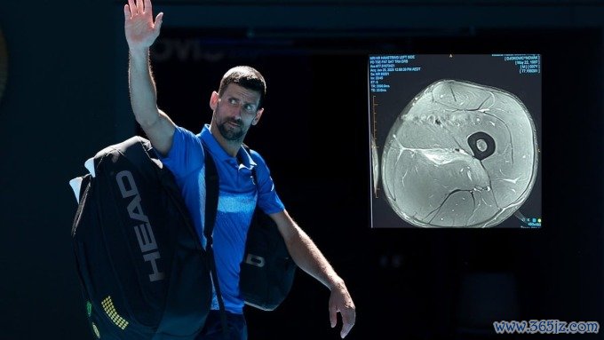 Phim chụp MRI vết rách cơ đùi của Djokovic. Ảnh: Reuters